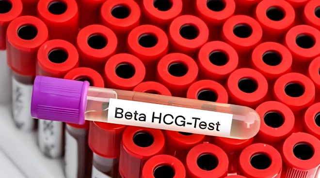 HCG test