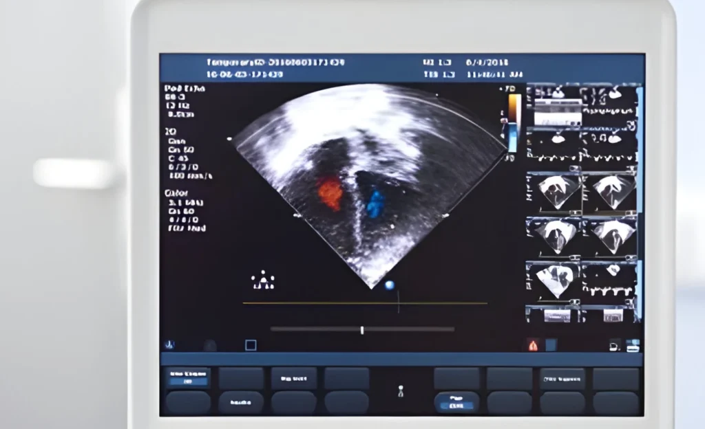 The Role of Color Doppler Ultrasound in Monitoring Pregnancies
